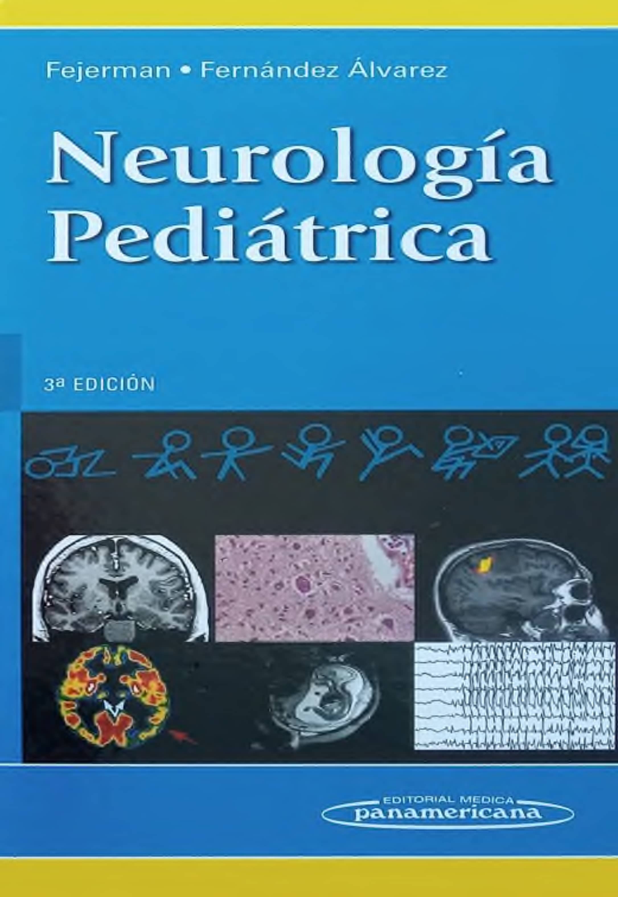 Portada Neurología pediátrica