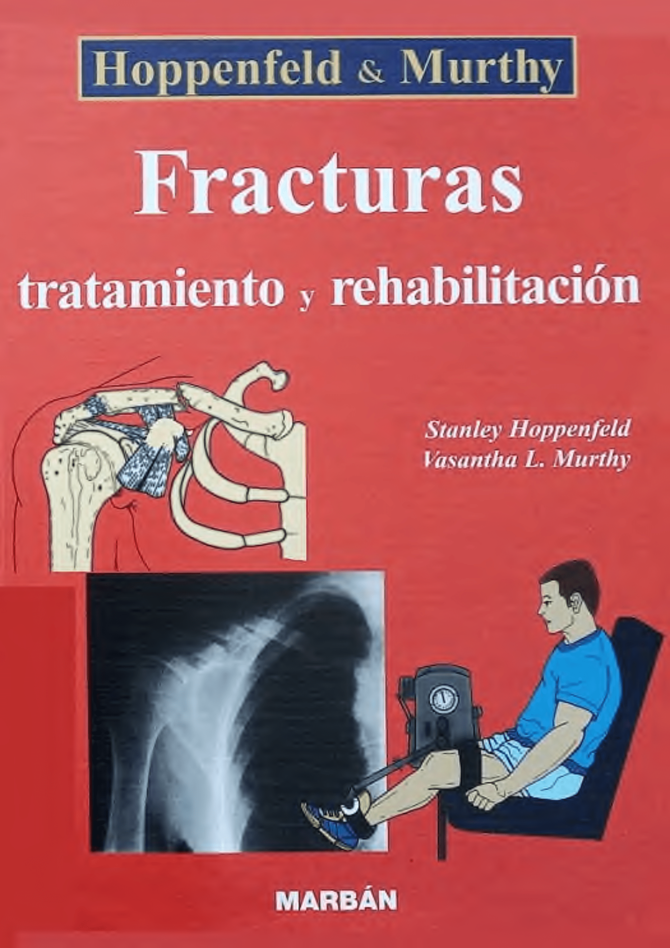 Portada Fracturas : tratamiento y rehabilitación